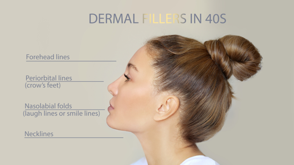 Dermal Fillers Treatment