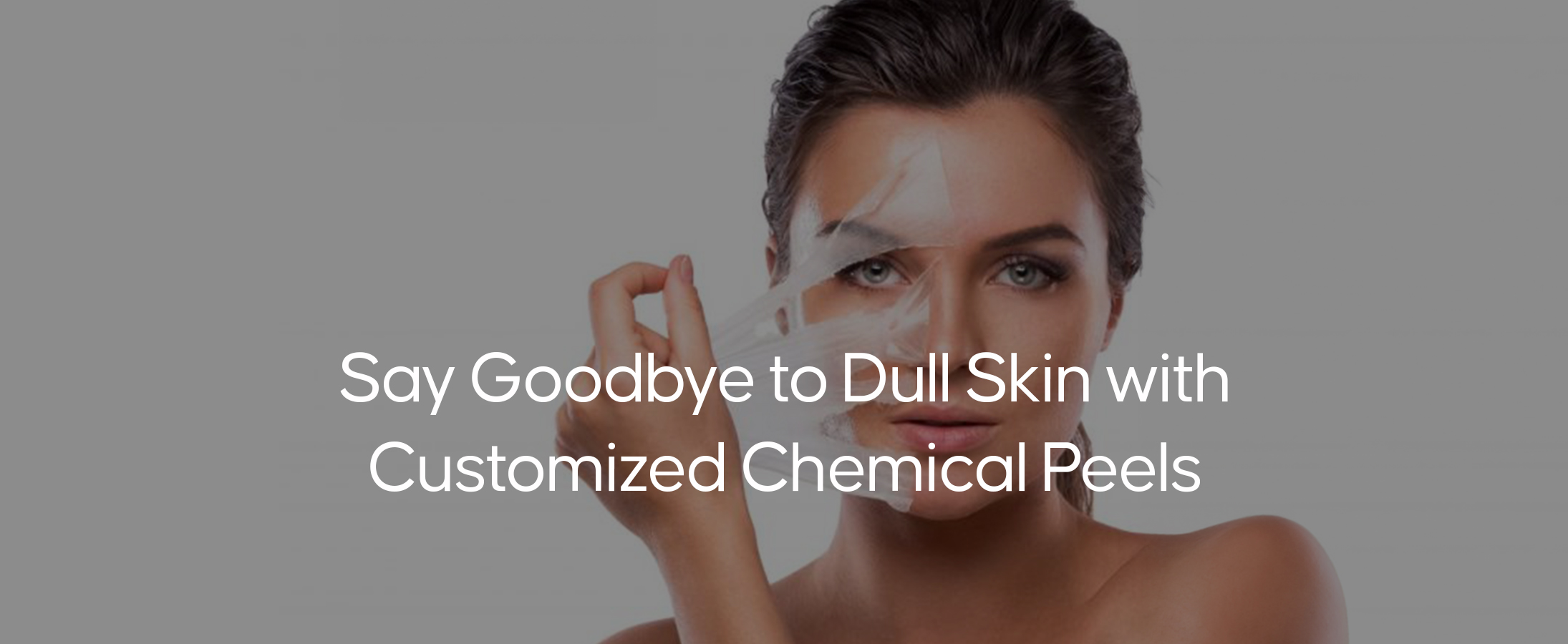 Chemical Peels