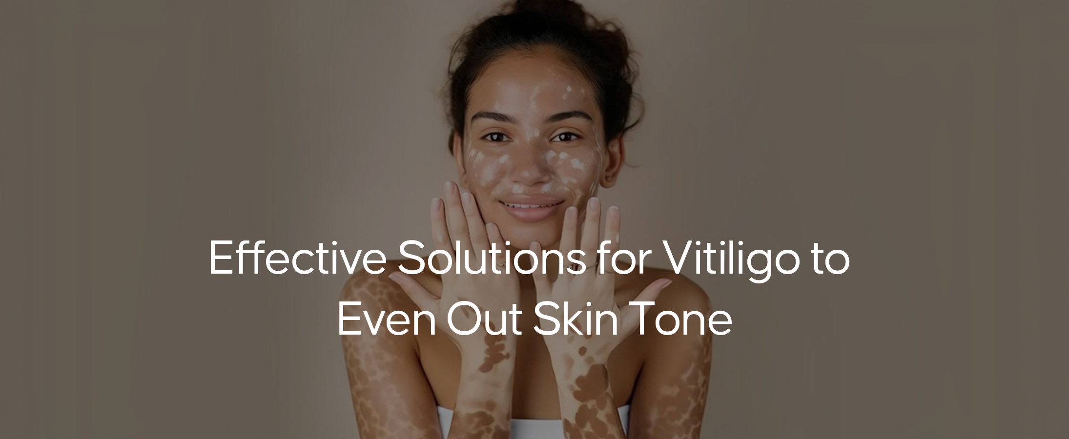 Vitiligo Treatment