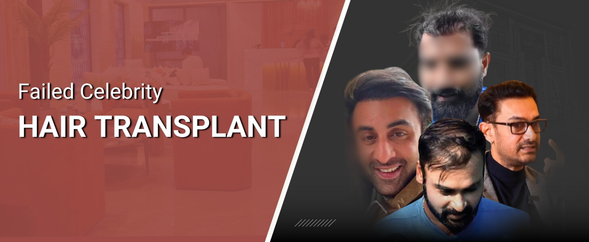 Satya Skin And Hair Transplant Clinic Best Skin And Hair Transplant Clinic In India | Satya